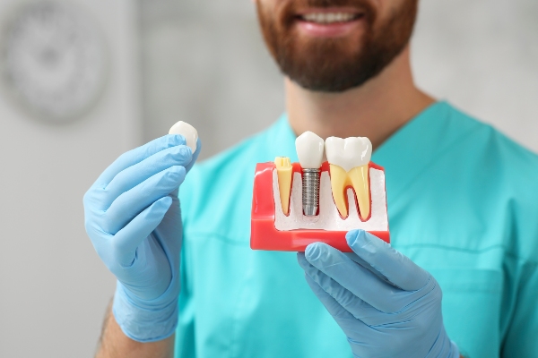 How Dental Implants Can Be Good For Your Jawbone