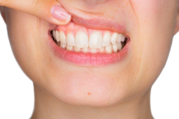 Common Questions About Gum Disease Treatment From A Periodontist