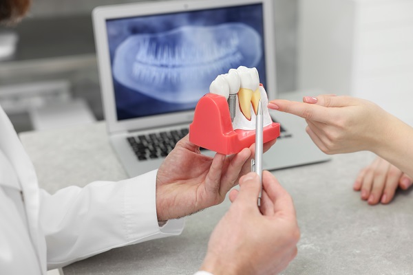 When A Tooth Extraction May Be Recommended